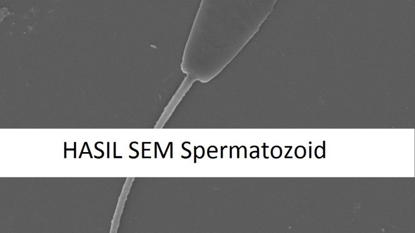 Spermatozoid